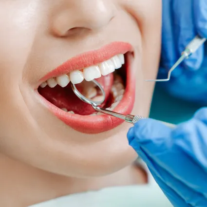 Tooth Extractions