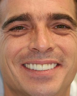 Closeup of man with great teeth